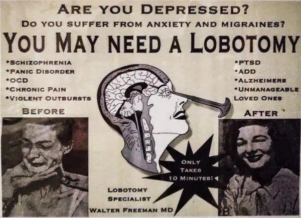 Lobotomy